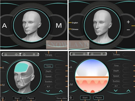 Máy loại bỏ lông laser diode laser bán dẫn 808nm với cảm biến tiếp xúc da đảm bảo điều trị loại bỏ lông nhanh