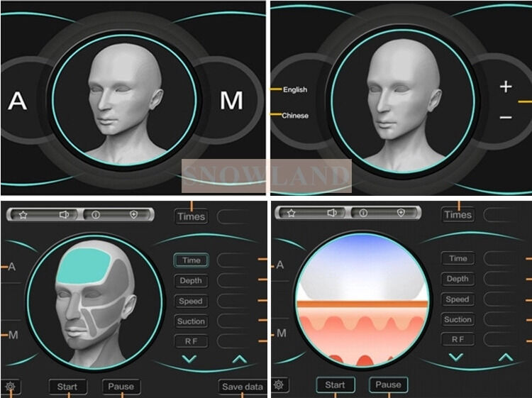 Máy loại bỏ lông laser diode laser bán dẫn 808nm với cảm biến tiếp xúc da đảm bảo điều trị loại bỏ lông nhanh